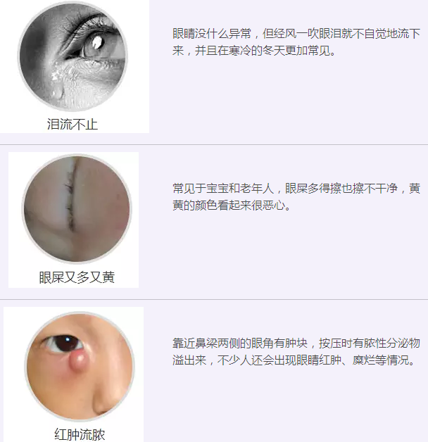 12月17日，普瑞集團(tuán)淚道專家來疆親診，預(yù)約請(qǐng)速！